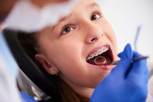 De fasen van een orthodontische behandeling bij kinderen